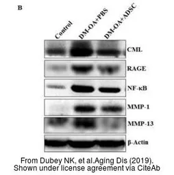 Anti-MMP1 antibody used in Western Blot (WB). GTX100534