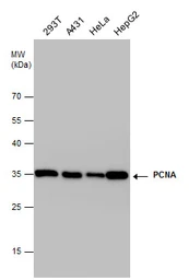 Anti-PCNA antibody used in Western Blot (WB). GTX100539