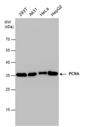 Anti-PCNA antibody used in Western Blot (WB). GTX100539