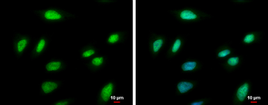 Anti-PCNA antibody used in Immunocytochemistry/ Immunofluorescence (ICC/IF). GTX100539