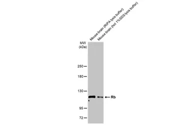 Anti-Rb antibody used in Western Blot (WB). GTX100545