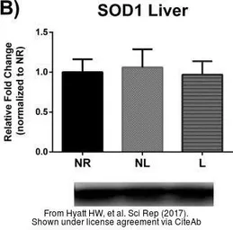 Anti-SOD1 antibody used in Western Blot (WB). GTX100554