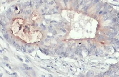 Anti-CD133 antibody [C1C2], Internal used in IHC (Paraffin sections) (IHC-P). GTX100567