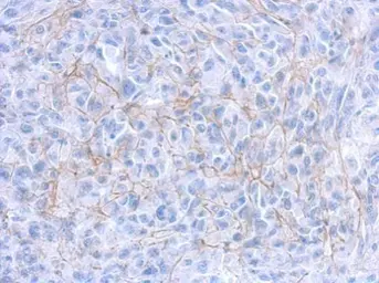 Anti-CD133 antibody [C1C2], Internal used in IHC (Paraffin sections) (IHC-P). GTX100567