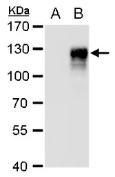 Anti-CD133 antibody [C1C2], Internal used in Western Blot (WB). GTX100567