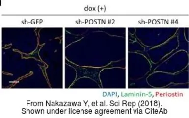Anti-Periostin antibody used in IHC (Paraffin sections) (IHC-P). GTX100602