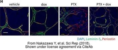 Anti-Periostin antibody used in IHC (Paraffin sections) (IHC-P). GTX100602