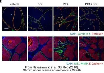 Anti-Periostin antibody used in IHC (Paraffin sections) (IHC-P). GTX100602
