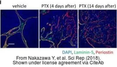Anti-Periostin antibody used in IHC (Paraffin sections) (IHC-P). GTX100602