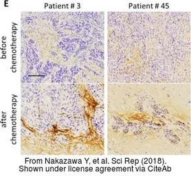 Anti-Periostin antibody used in IHC (Paraffin sections) (IHC-P). GTX100602
