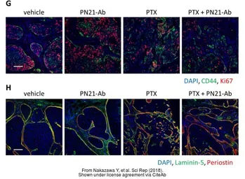 Anti-Periostin antibody used in IHC (Paraffin sections) (IHC-P). GTX100602