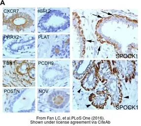 Anti-Periostin antibody used in IHC (Paraffin sections) (IHC-P). GTX100602