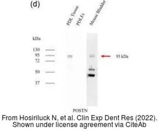 Anti-Periostin antibody used in Western Blot (WB). GTX100602