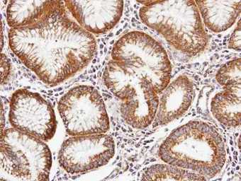 Anti-Periostin antibody used in IHC (Paraffin sections) (IHC-P). GTX100602