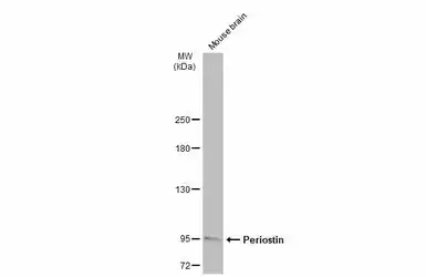 Anti-Periostin antibody used in Western Blot (WB). GTX100602