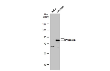 Anti-Periostin antibody used in Western Blot (WB). GTX100602