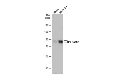 Anti-Periostin antibody used in Western Blot (WB). GTX100602