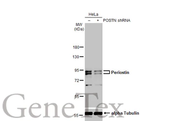 Anti-Periostin antibody used in Western Blot (WB). GTX100602