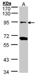Anti-Periostin antibody used in Western Blot (WB). GTX100602