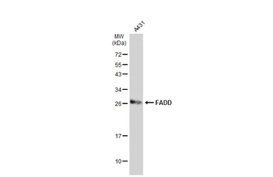 Anti-FADD antibody used in Western Blot (WB). GTX100612