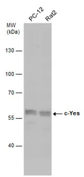 Anti-c-Yes antibody used in Western Blot (WB). GTX100616
