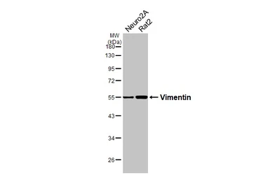 Anti-Vimentin antibody used in Western Blot (WB). GTX100619