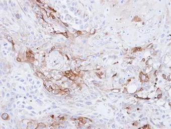 Anti-CD36 antibody [C1C3] used in IHC (Paraffin sections) (IHC-P). GTX100642