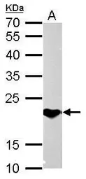 Anti-SOCS1 antibody used in Western Blot (WB). GTX100657