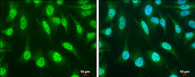 Anti-SOCS1 antibody used in Immunocytochemistry/ Immunofluorescence (ICC/IF). GTX100657