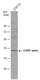 Anti-C/EBP alpha antibody [N1], N-term used in Western Blot (WB). GTX100674