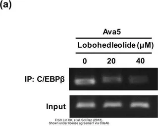 Anti-C/EBP beta antibody used in ChIP assay (ChIP assay). GTX100675