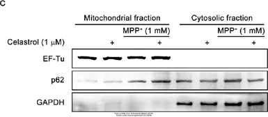 Anti-SQSTM1 / P62 antibody [N3C1], Internal used in Western Blot (WB). GTX100685