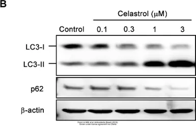 Anti-SQSTM1 / P62 antibody [N3C1], Internal used in Western Blot (WB). GTX100685