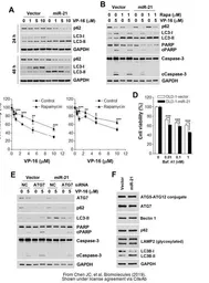 Anti-SQSTM1 / P62 antibody [N3C1], Internal used in Western Blot (WB). GTX100685