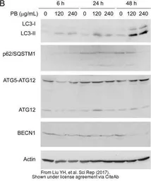 Anti-SQSTM1 / P62 antibody [N3C1], Internal used in Western Blot (WB). GTX100685