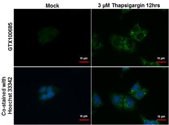 Anti-SQSTM1 / P62 antibody [N3C1], Internal used in Immunocytochemistry/ Immunofluorescence (ICC/IF). GTX100685
