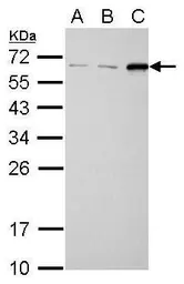 Anti-SQSTM1 / P62 antibody [N3C1], Internal used in Western Blot (WB). GTX100685