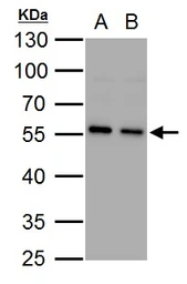 Anti-SQSTM1 / P62 antibody [N3C1], Internal used in Western Blot (WB). GTX100685