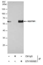 Anti-SQSTM1 / P62 antibody [N3C1], Internal used in Immunoprecipitation (IP). GTX100685