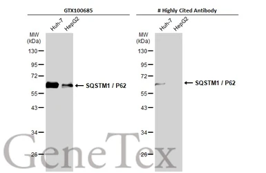 Anti-SQSTM1 / P62 antibody [N3C1], Internal used in Western Blot (WB). GTX100685