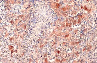 Anti-SQSTM1 / P62 antibody [N3C1], Internal used in IHC (Paraffin sections) (IHC-P). GTX100685