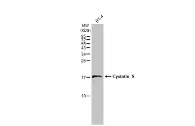 Anti-Cystatin S antibody [N1N3] used in Western Blot (WB). GTX100690