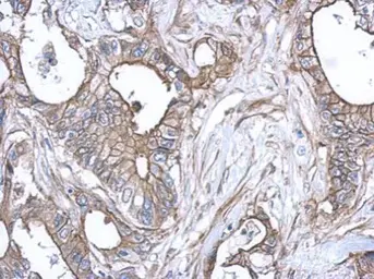 Anti-S100A10 antibody used in IHC (Paraffin sections) (IHC-P). GTX100697