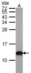 Anti-S100A10 antibody used in Western Blot (WB). GTX100697