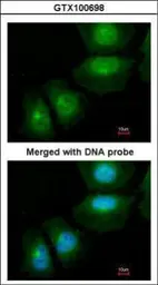 Anti-S100A11 antibody used in Immunocytochemistry/ Immunofluorescence (ICC/IF). GTX100698