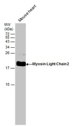 Anti-Myosin Light Chain 2 (MLC-2v) antibody used in Western Blot (WB). GTX100714