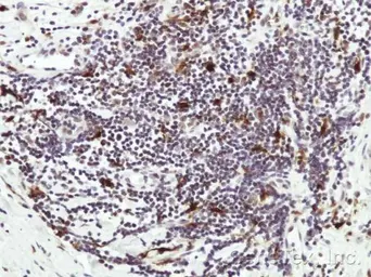 Anti-Hice1 antibody used in IHC (Paraffin sections) (IHC-P). GTX100735