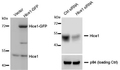 Anti-Hice1 antibody used in Western Blot (WB). GTX100735