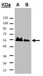 Anti-Hice1 antibody used in Western Blot (WB). GTX100735