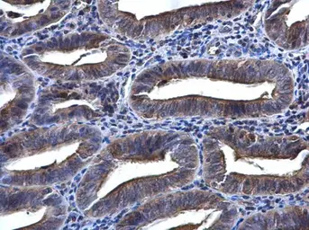 Anti-Syk antibody [N2C2], Internal used in IHC (Paraffin sections) (IHC-P). GTX100748